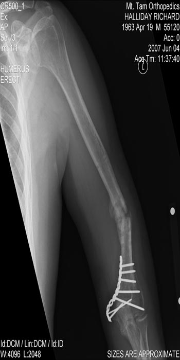 Before Operation