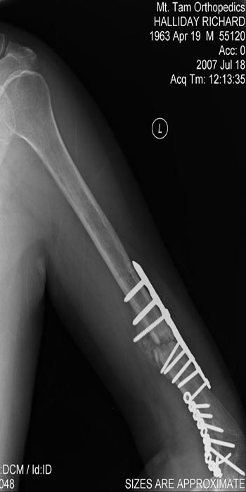 After Operation